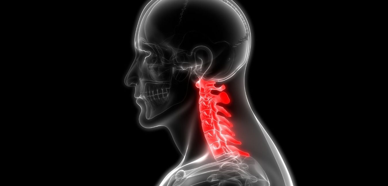 Bandscheibenvorfall HWS behandeln | American Chiro Care
